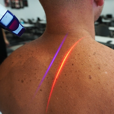 Chiropractic Canton GA Laser On Back